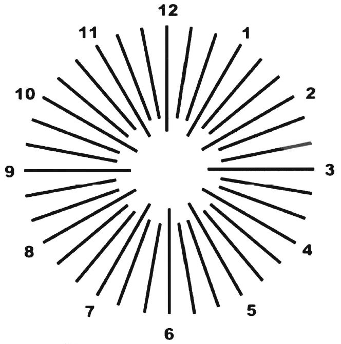 Astigmatism treatment - test