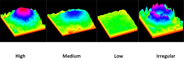 anti-glare computer eye strain-macular pigment variability in bluelight filtering