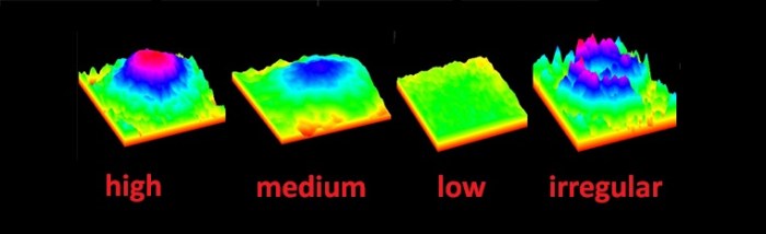 Lutein-meso-zeaxanthin eye supplements_macular pigment profiles